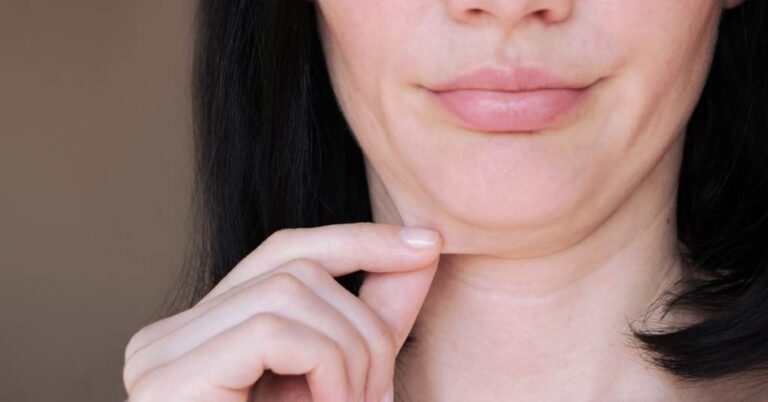 What is Tech Neck Wrinkles