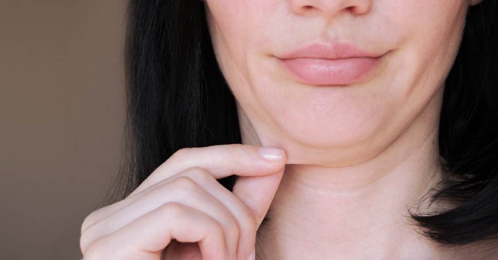 What is Tech Neck Wrinkles